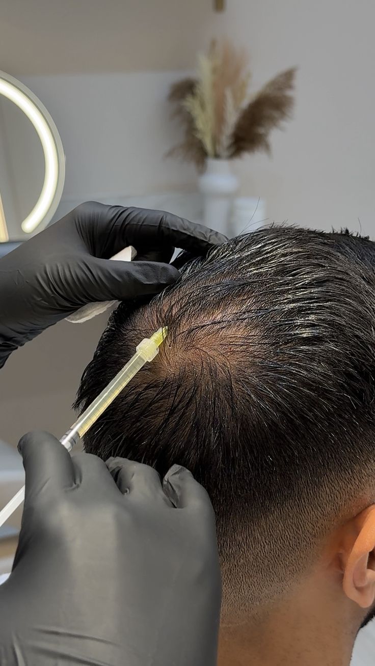 Hair restoration and thinning-hair treatment at Healing Aesthetics in Hinsdale, IL