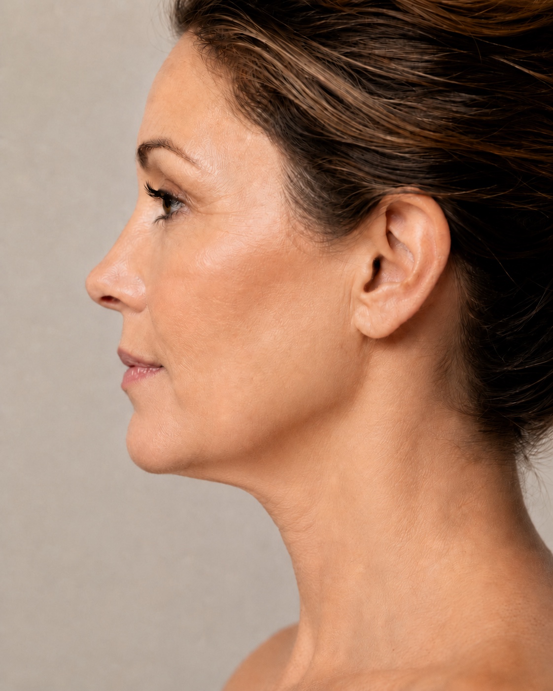 Woman with smooth, rejuvenated neck and jawline after treatment