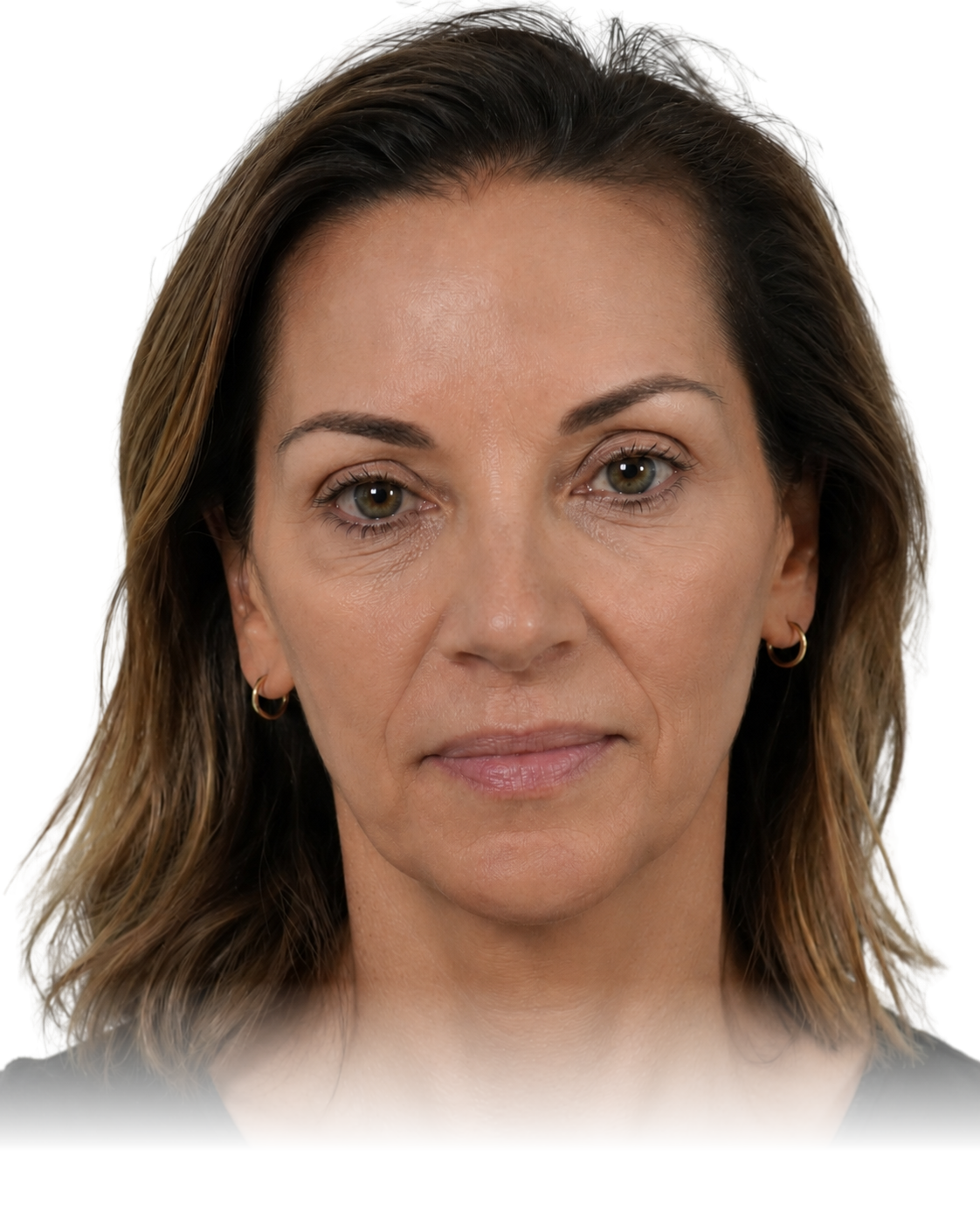The same woman's face after GLP-1 weight loss, looking hollow and aged