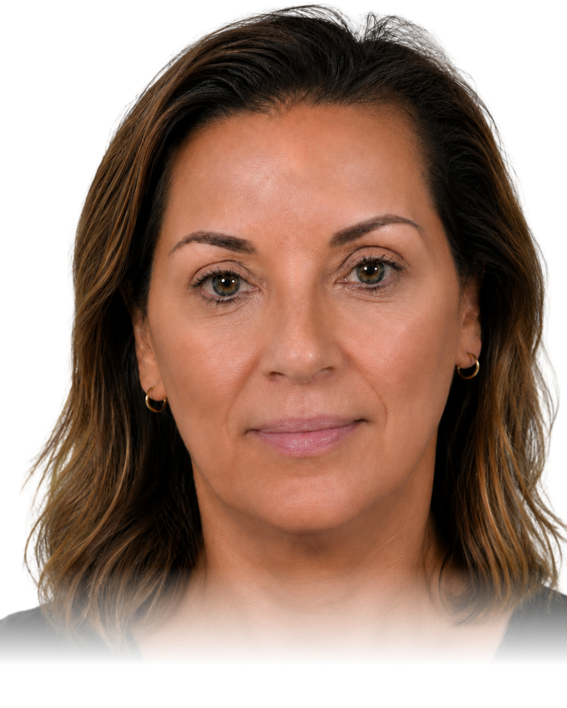 Woman's face before GLP-1 weight loss, with fuller volume
